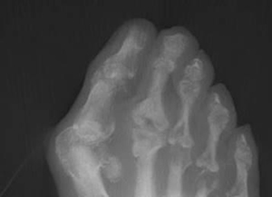X-Ray 2