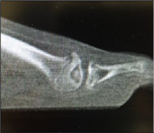 Source: Podiatry Today 