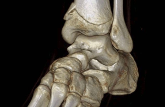 Skeletomuscular-Imaging-Use-Increased-Dramatically