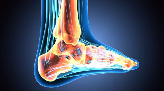 WBCT & MRI Study Sheds Light on Flat Foot Degeneration