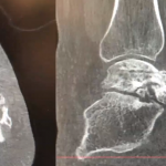 Axial and Sagittal View